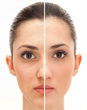 Soin starter nettoyant